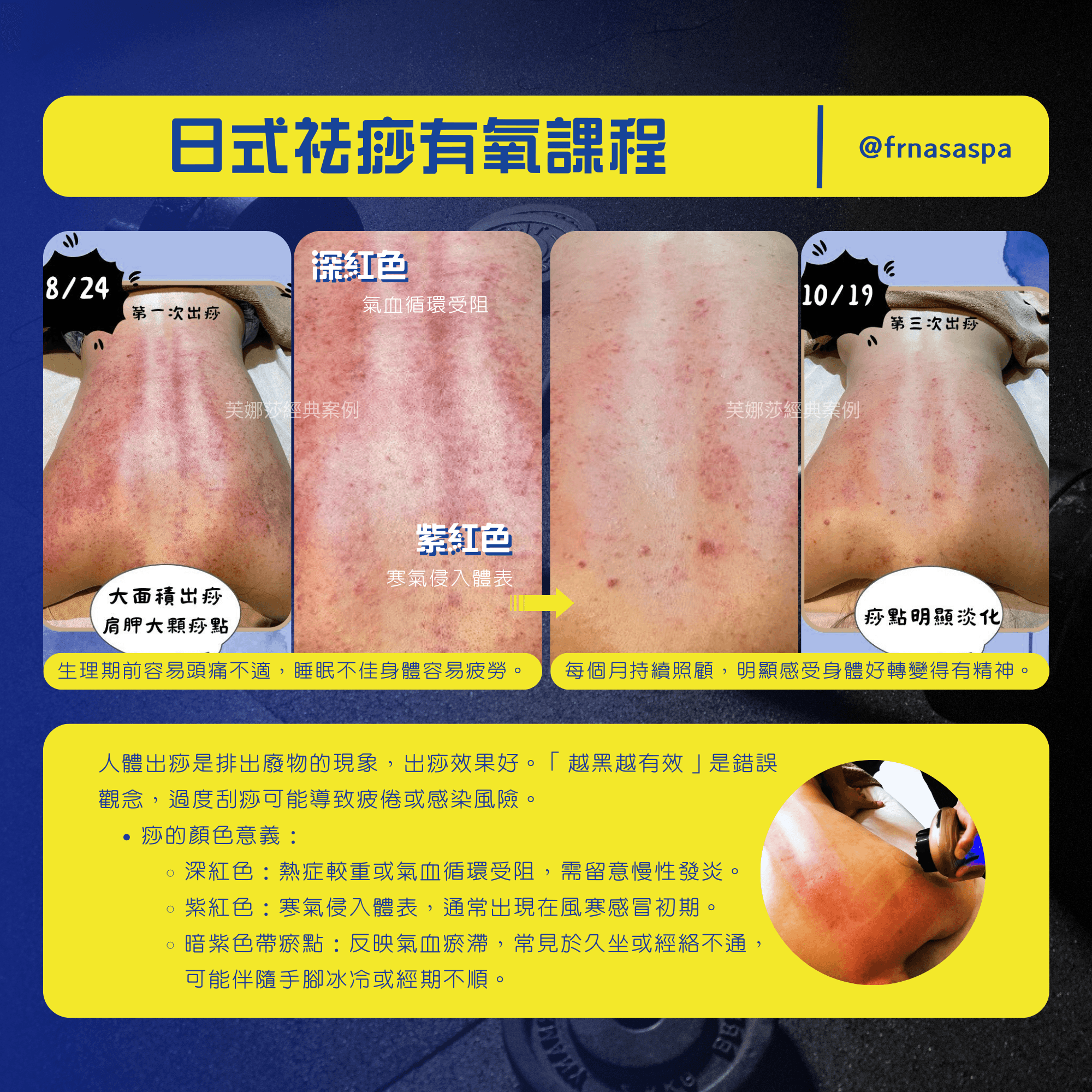 3-6 日式袪痧有氧spa01.png