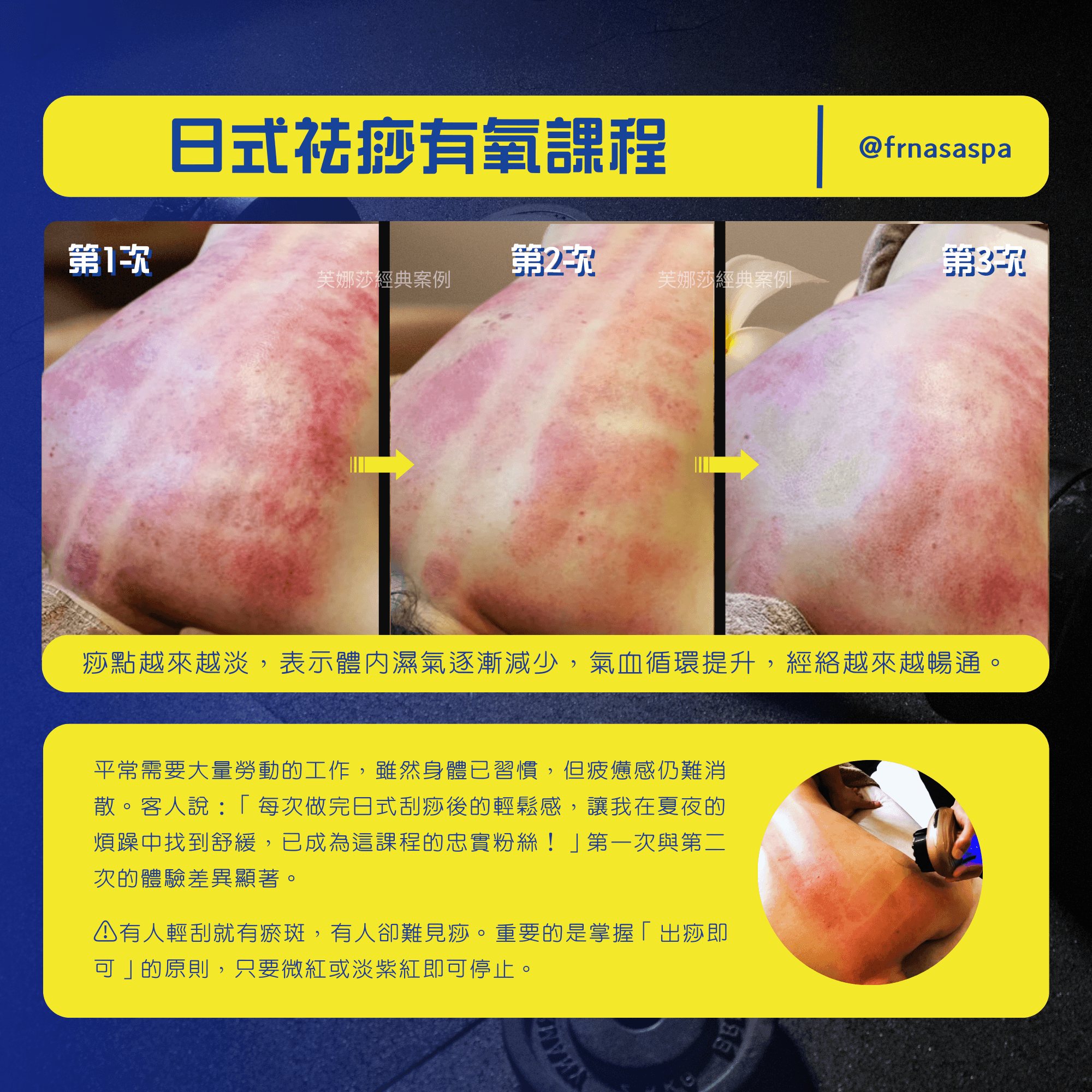 3-6 日式袪痧有氧spa02.png