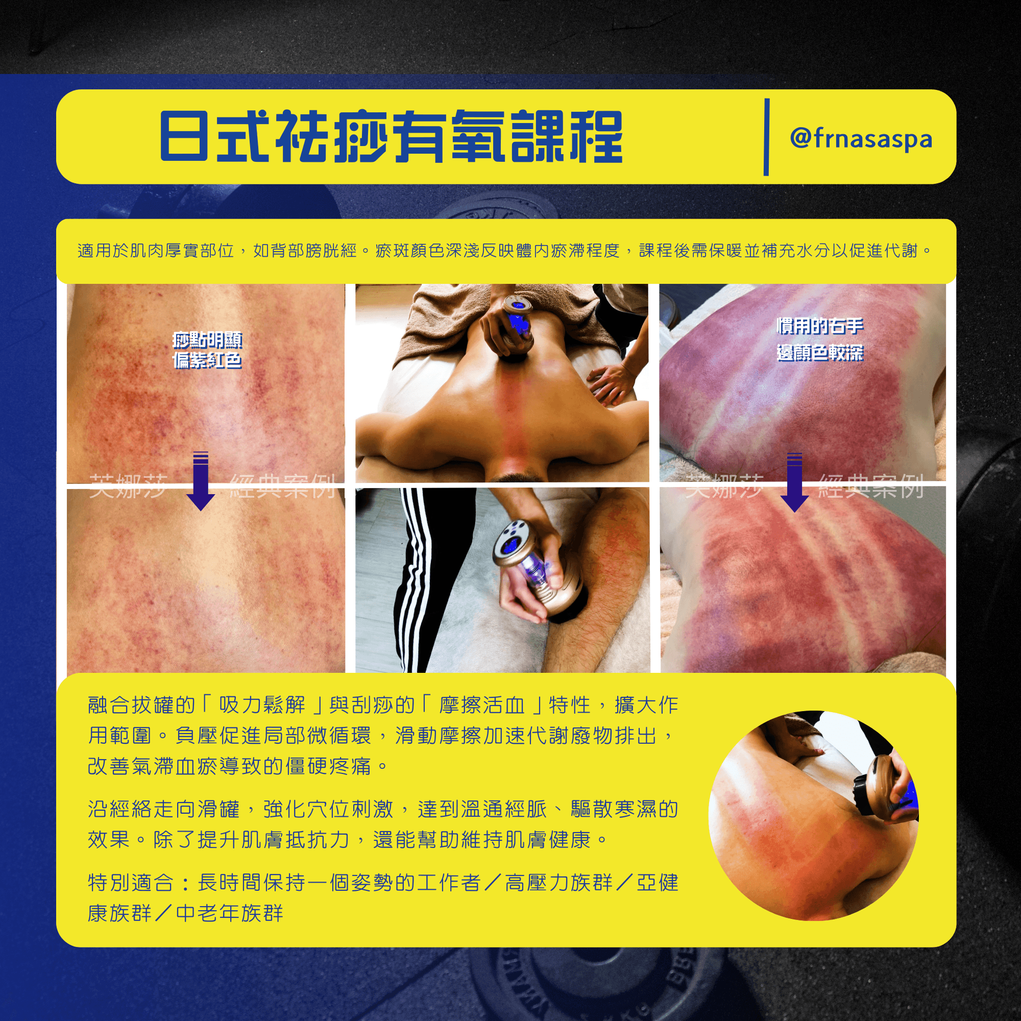 3-6 日式袪痧有氧spa03.png