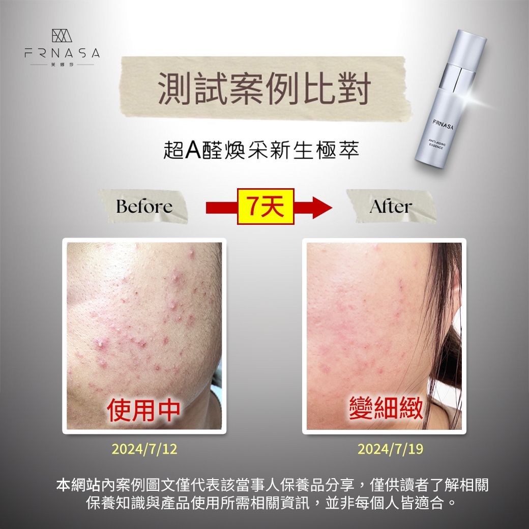 超A醛DM案例03.jpg