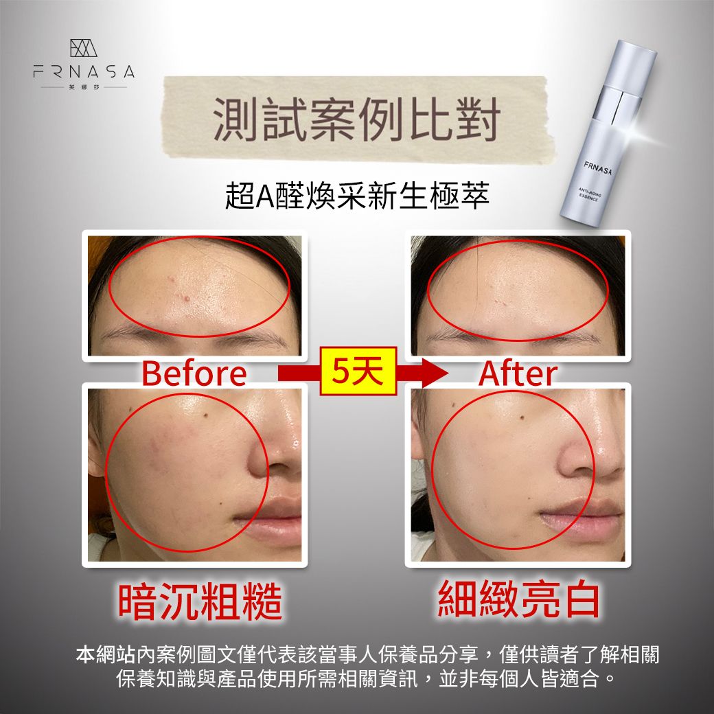 超A醛DM案例04.jpg