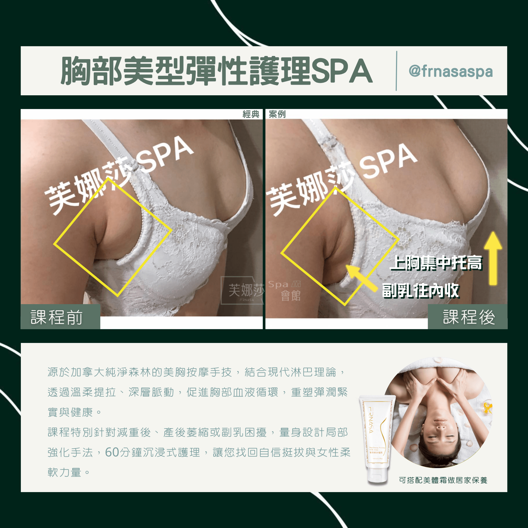 4-4案例比對-胸部美型彈性護理04.png