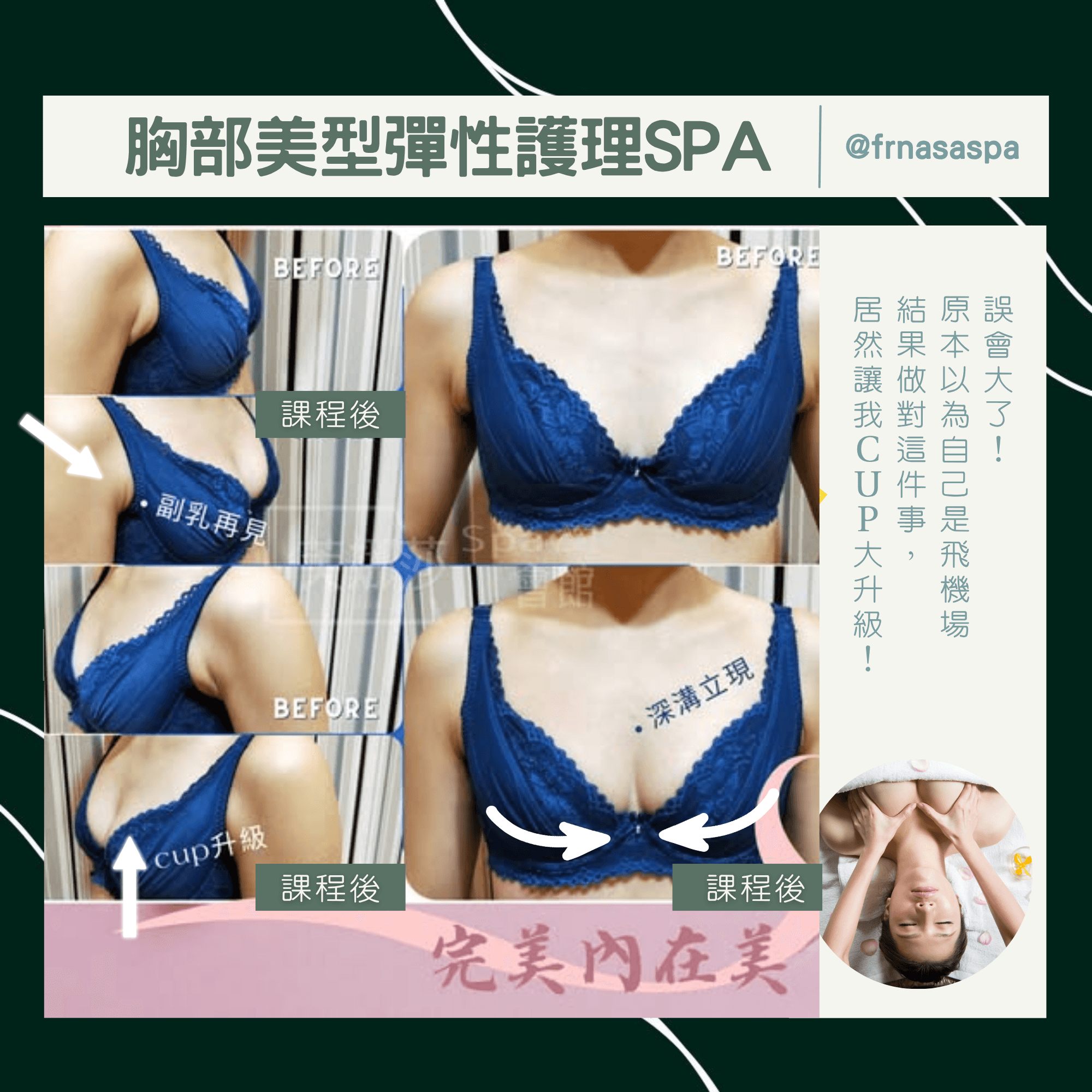 4-4案例比對-胸部美型彈性護理05.png