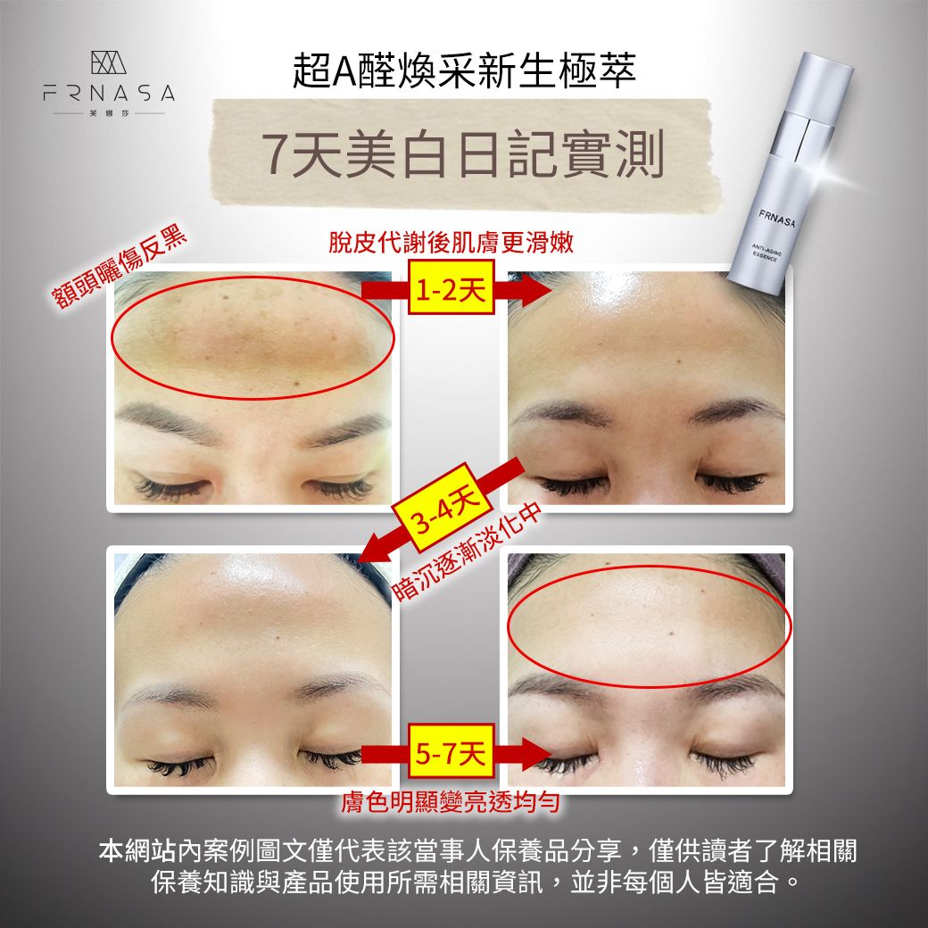 超A醛DM案例05.jpg