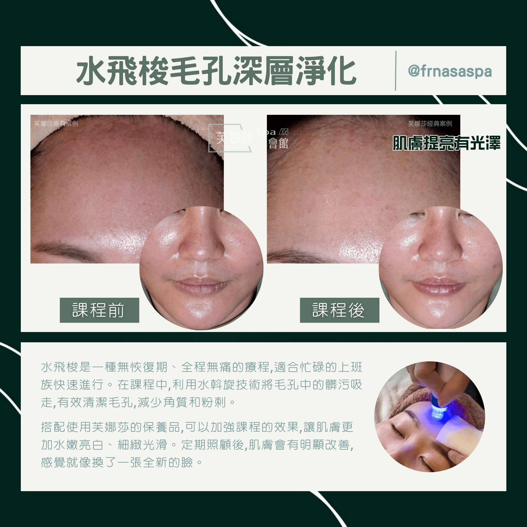 6-1案例比對-水飛梭02.png