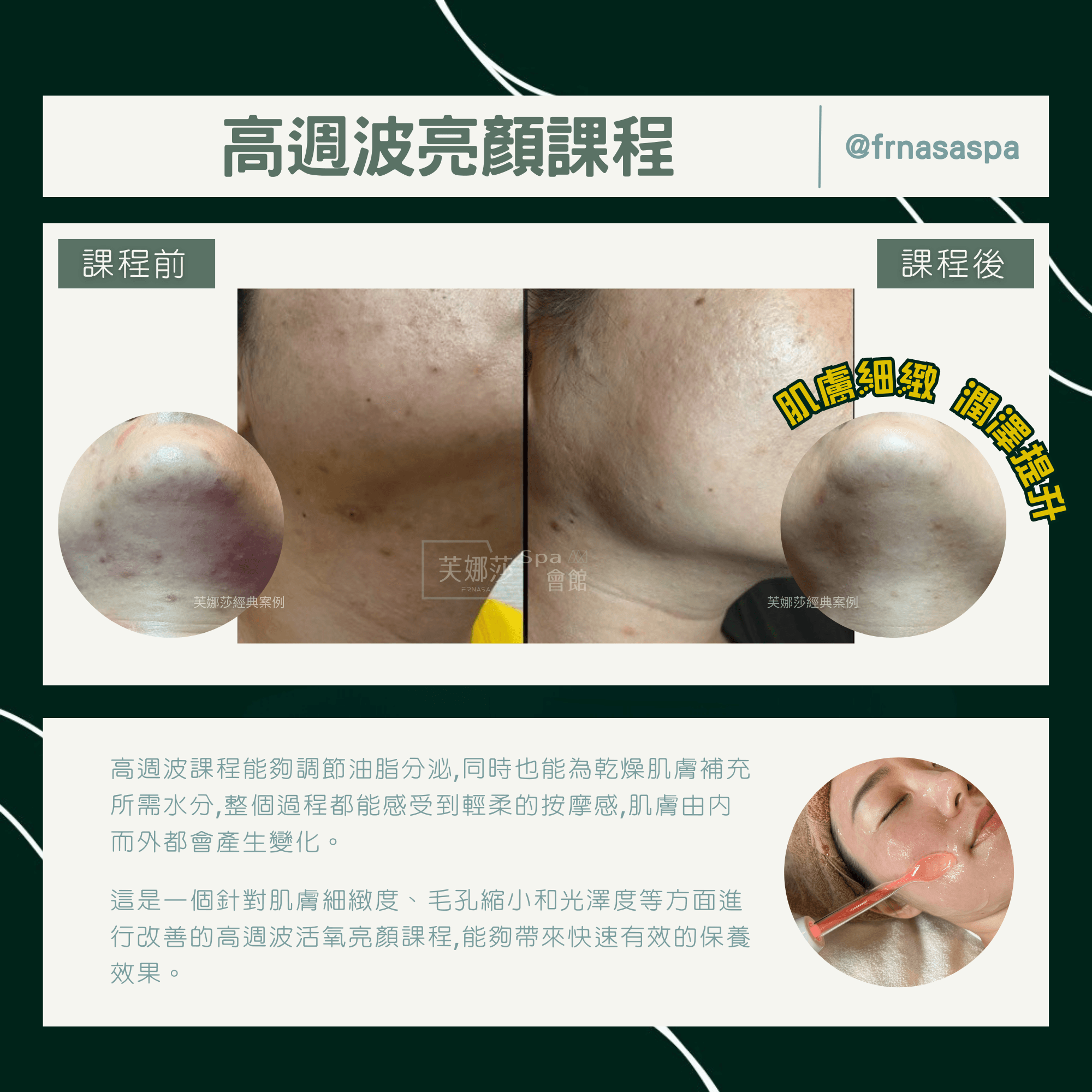 6-2案例比對-高週波02.png