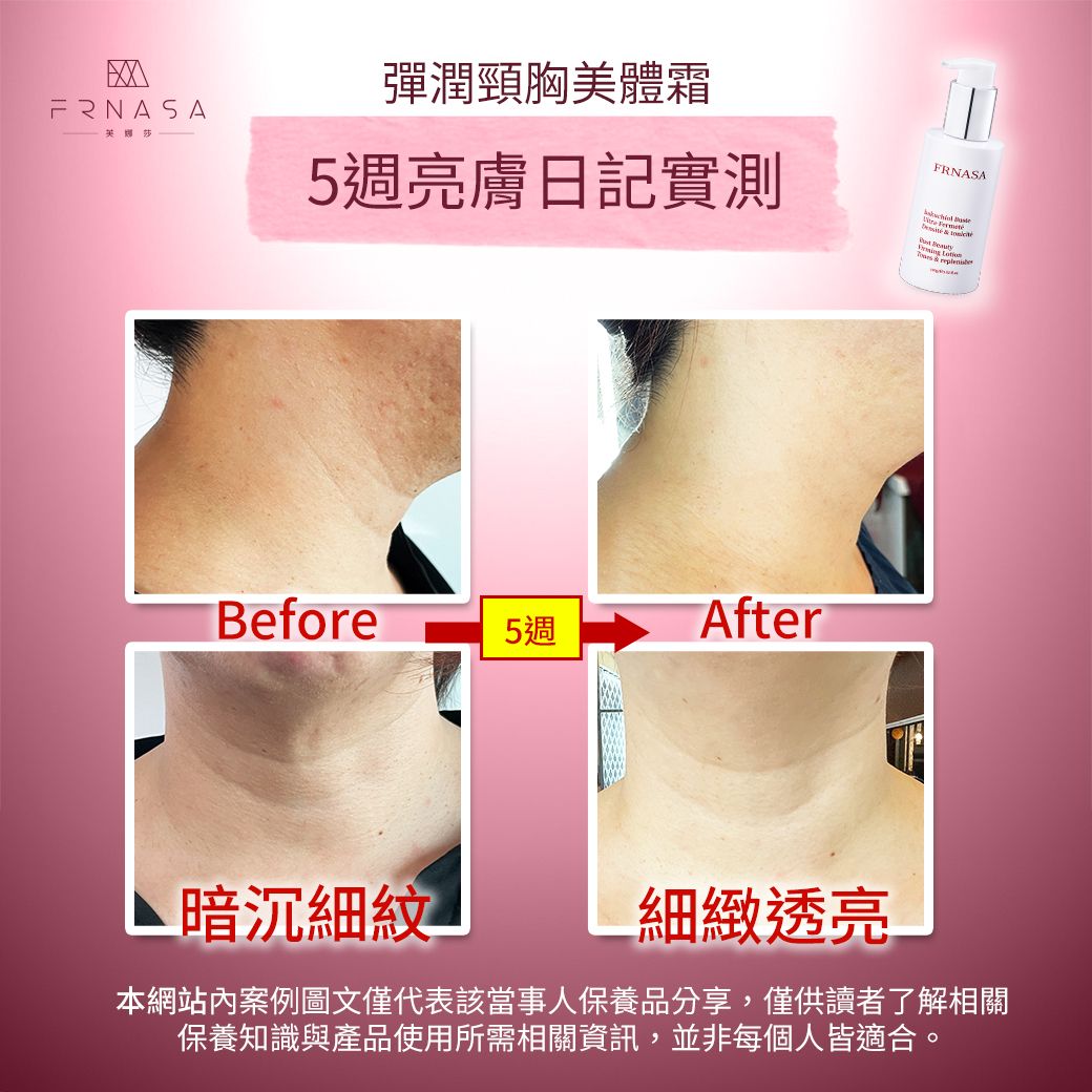 頸胸霜DM案例01.jpg